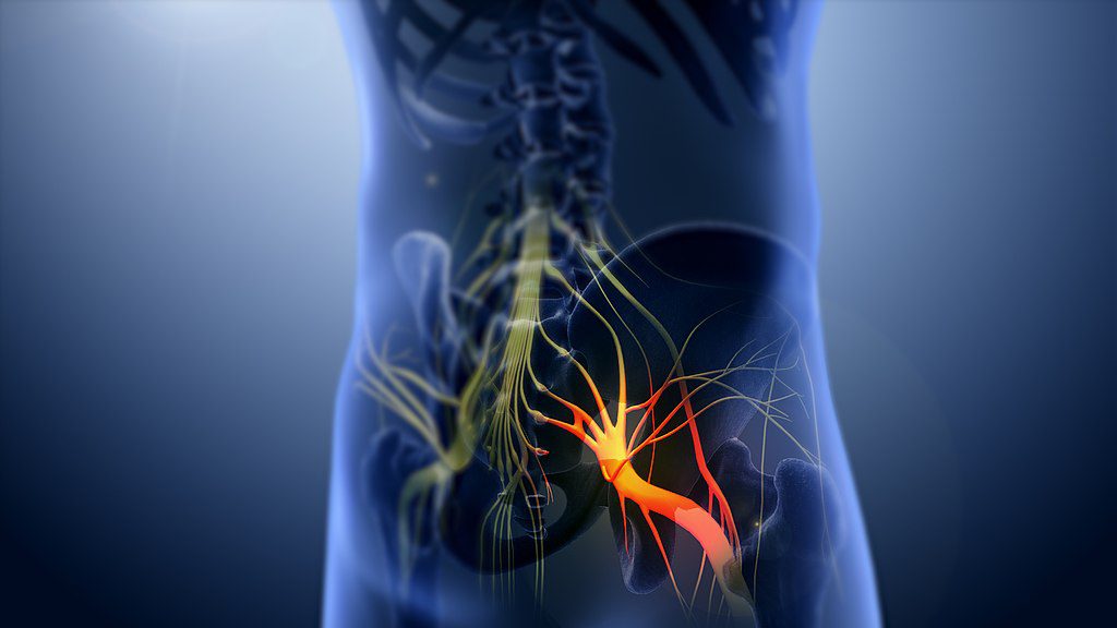 Ból nóg - rodzaje, przyczyny i leczenie - nerw kulszowy