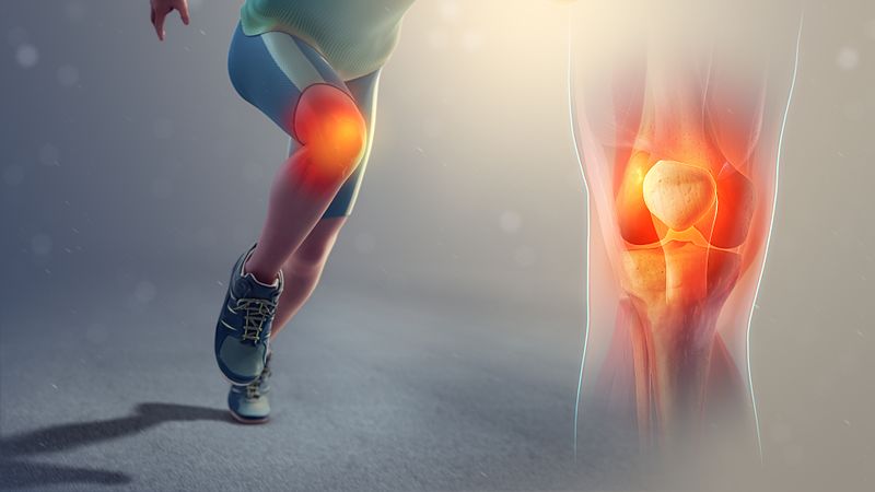 Ból kolana - Kolano biegacza